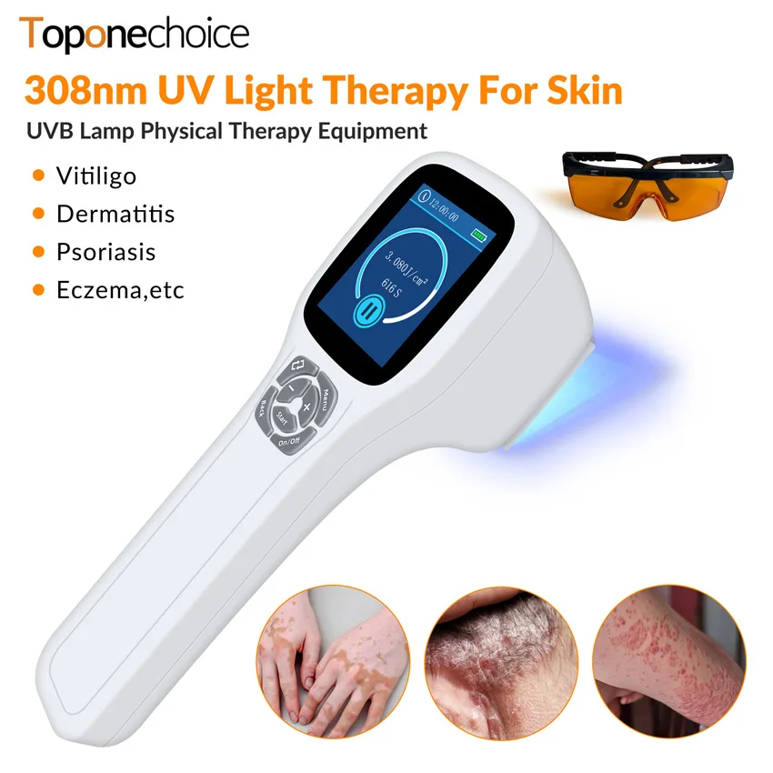 

Vitiligo Treatment Ultraviolet Phototherapy Instrument 308nm Excimer UVB Lamp UV Light for Eczema Psoriasis White Spot 49 Diodes