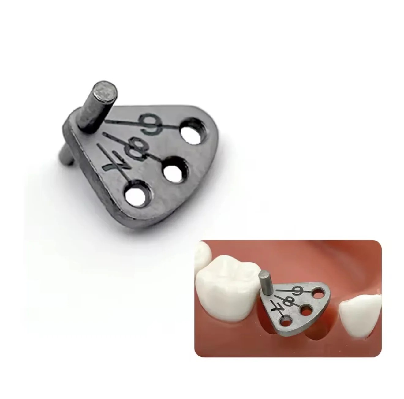 DENILK 1pc Dental implant Parallel Pin Gauge Stainless Steel Medical Lacator Dental Implant Locatring Guide Locating Ruler