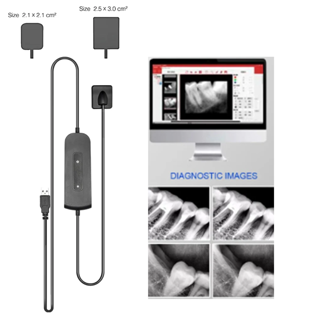 

Dentistry Dental Sensor X-Ray Dental High-Frequency Rx Digital Intraoral Digital System H D Image Dentist Lab Implant Tools