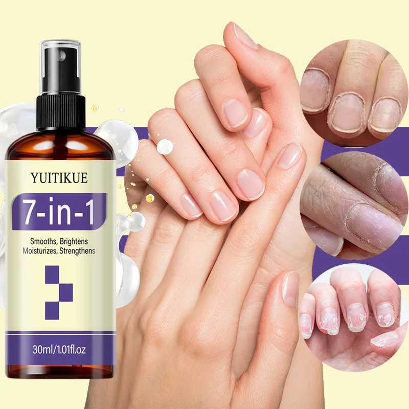 YUITIKUE 7-in-1 Nagelreparatur-Spray 30ml Biotin Keratin Stärken Aufhellen Befeuchten für Rissige Dünne Hand- und Fußnägel Pflegespray – Detail 2