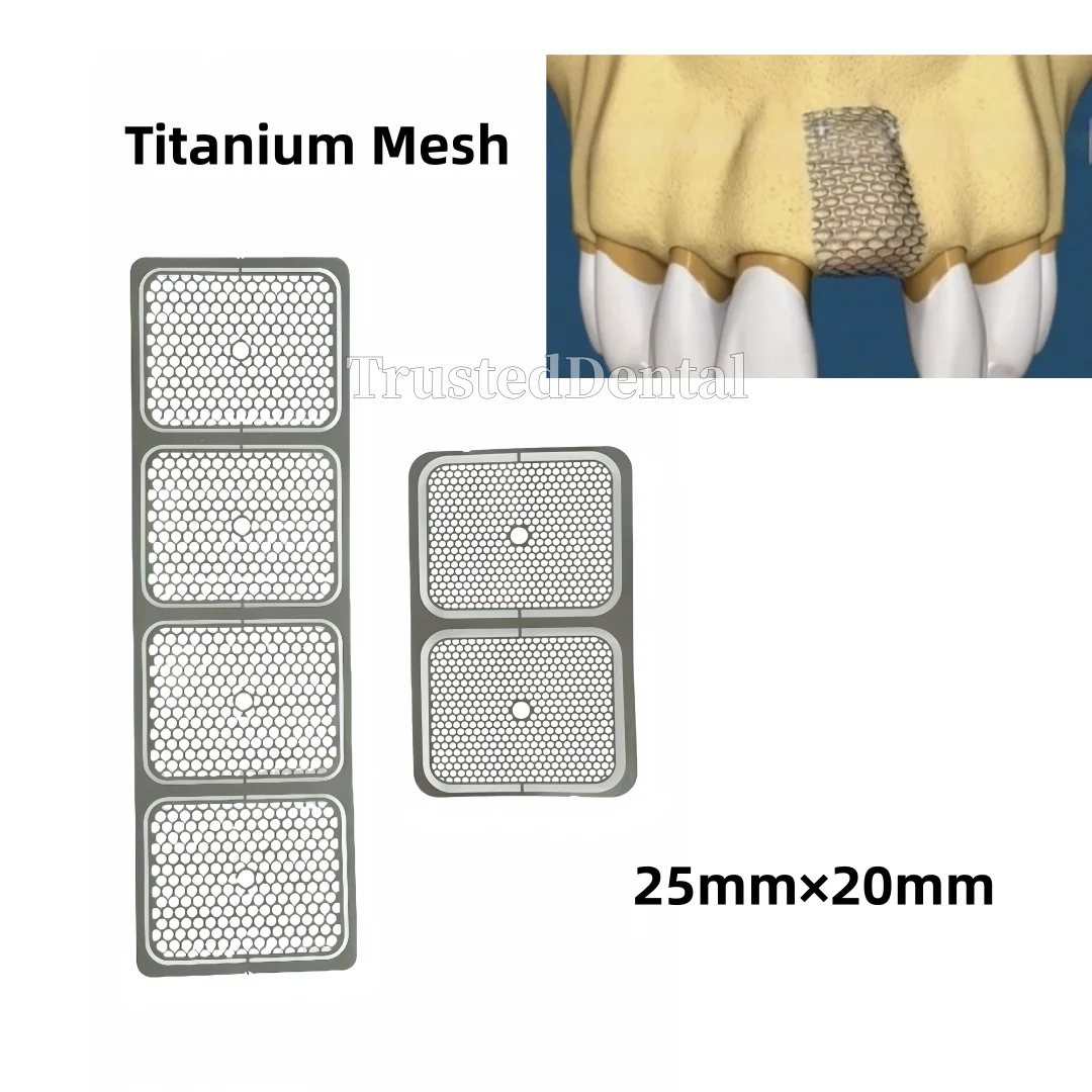 

Dental Fixture Titanium Barrier Membrane Mesh Plates GBR Dental Flexible and safety Titanium Mesh Membrane 25×20mm