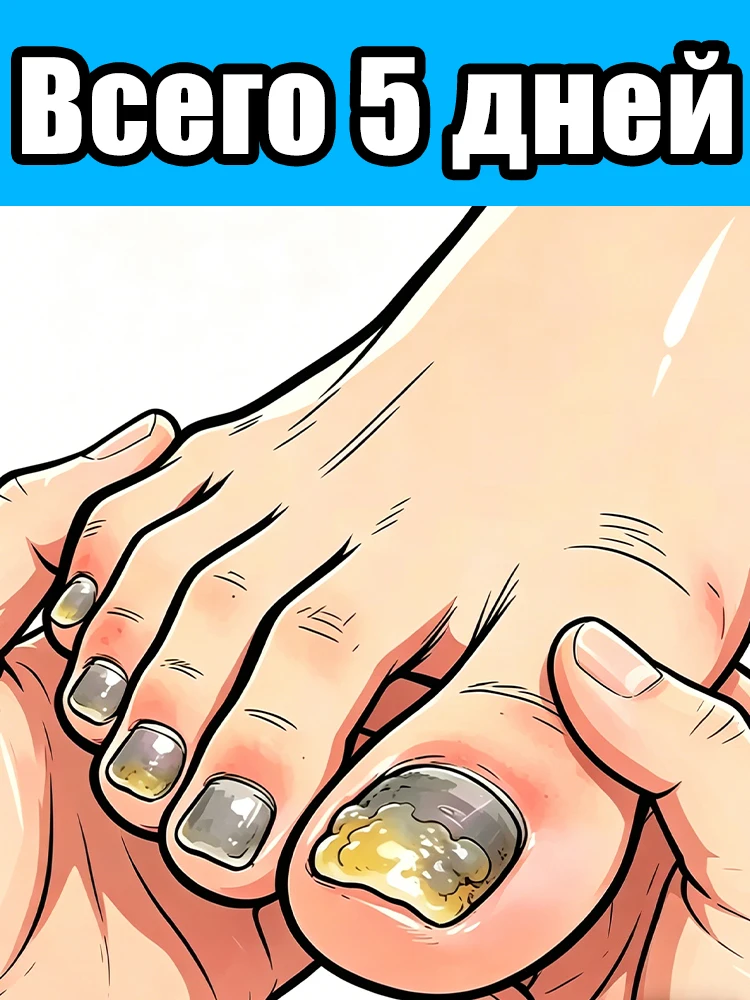 

2026 Восстановление блеска для уставших, тусклых ногтей