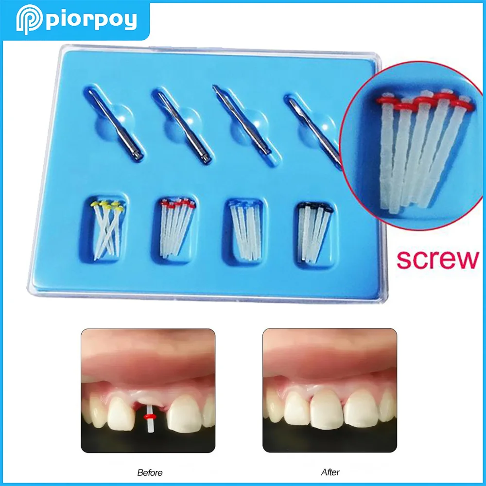 

PIORPOY Dental Fiber Posts Kit Dental Fibre Pile Thread Fiber Post 1.0/1.2/1.4/1.6mm 20 Posts+4 Dentistry Root Canal Drills