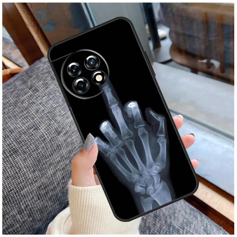 حافظة لهاتف OnePlus 13T 8T 10T 9 10 Pro 15 13 12 11 13R 12R Nord CE 5 2 3 4 Lite N20 N30 Coque #6