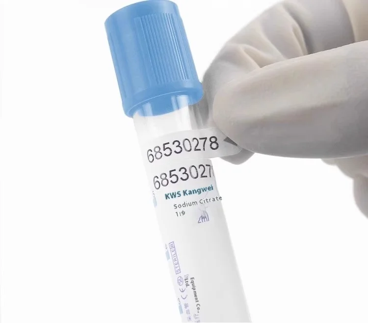 Einweg-Natriumcitrat 1:9 Sterile Vakuum-Blutentnahmeröhrchen 10ml/5ml/2ml Veterinär 100 Stück Kunststoff-Probenentnahmeröhrchen – Detail 6