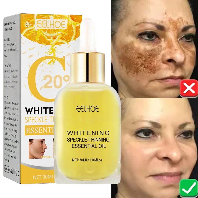 

Vitamin C Whitening Freckles Serum Remove Dark Spots Freckles Fade Melanin Nicotinamide Essence Brighten Moisturizing Skin Care