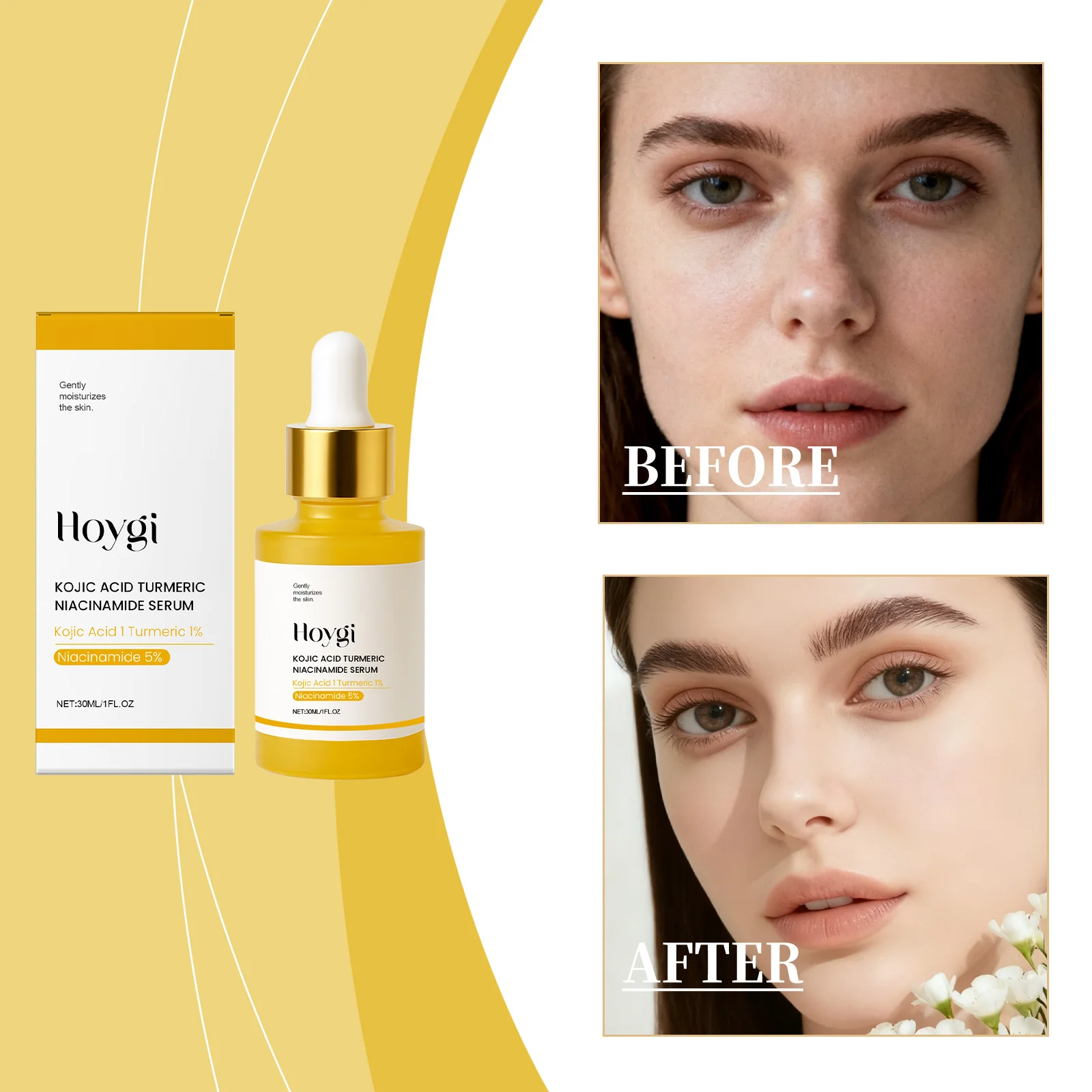 ホイギ5%ナイアシンアミドセラム（コウジ酸＆ターメリック配合）保湿・滑らか肌ケア、保湿弾力肌へ