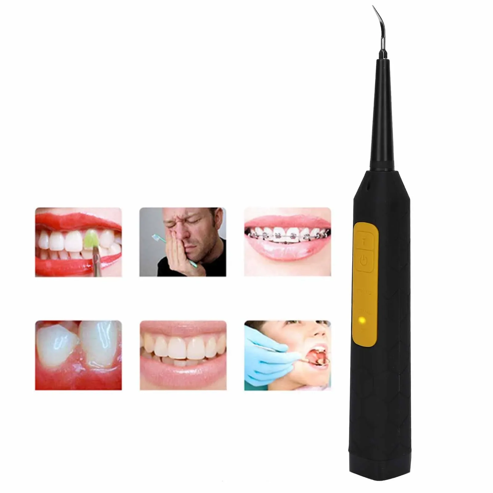 

HighQuality Stainless Steel Head Tooth Cleaner Electric Calculus Remover Portable Teeth Tartar Remover Oral Care Tool USB Charg