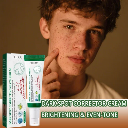 Imagen 2 del producto Crema correctora de manchas oscuras que reduce las manchas oscuras, el cuidado iluminador, hidrata y nutre la piel, reduce la melanina, desvanece las manchas, las pecas