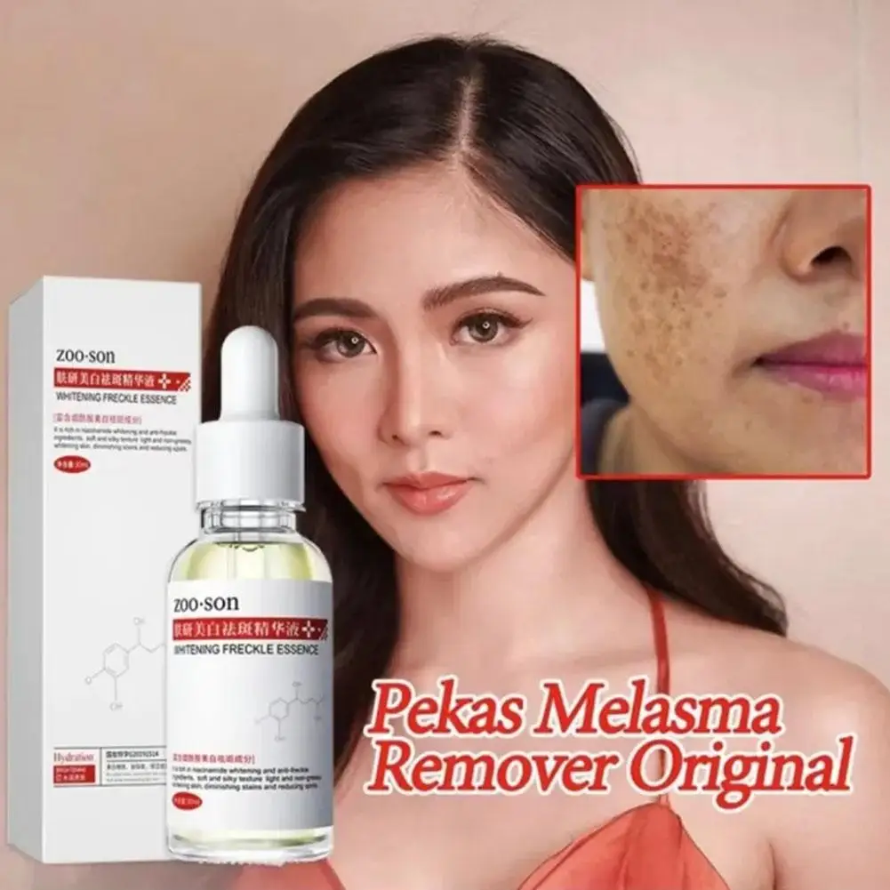 Suero blanqueador para pecas, esencia para eliminar manchas oscuras, niacinamida antienvejecimiento, pigmentación, Melasma, ilumina el cuidado de la piel