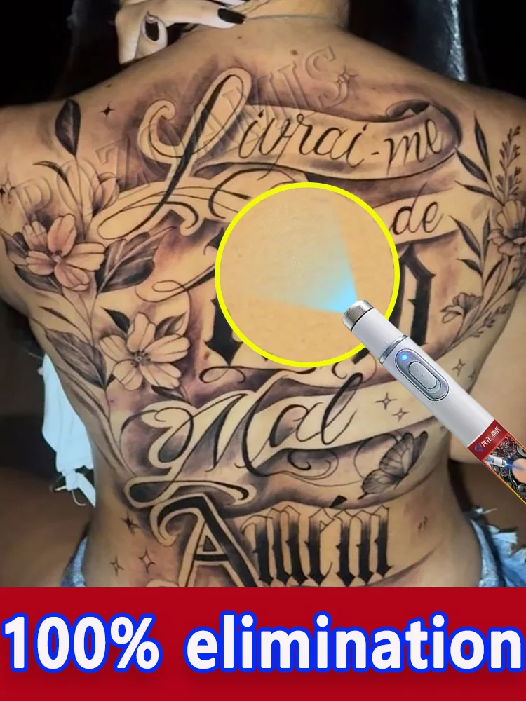 

Удаление татуировок разных размеров, дизайнов и цветов.