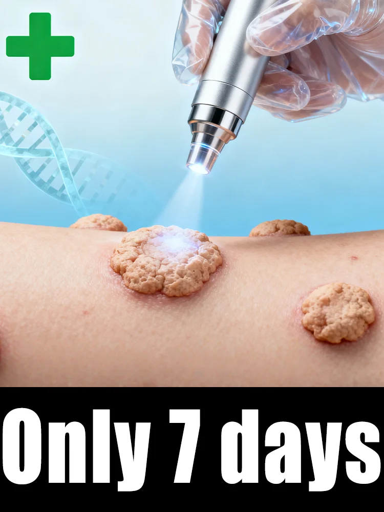 

Gᴇɴᴇʀᴀᴛɪᴏɴ-2 Lᴀsᴇʀ Sᴀʏs Gᴏᴏᴅʙʏᴇ Tᴏ ᴀʟʟ ᴡᴀʀᴛs Iɴ 7 Dᴀʏs