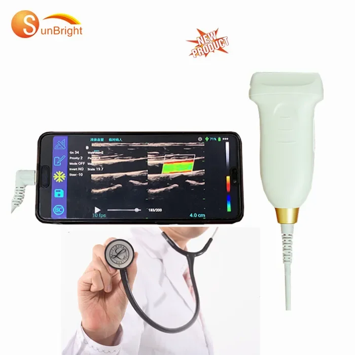 ecograph ultrasound echo scanner Ultrasound probe for Android color Doppler USB wireless Linear Probe