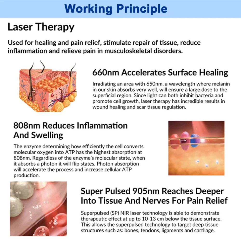 Frovab 65 واط 905nm جهاز العلاج بالليزر النبضي الفائق LLLT التهاب المفاصل الإغاثة الأنسجة العميقة إصلاح آلة العلاج الطبيعي #2