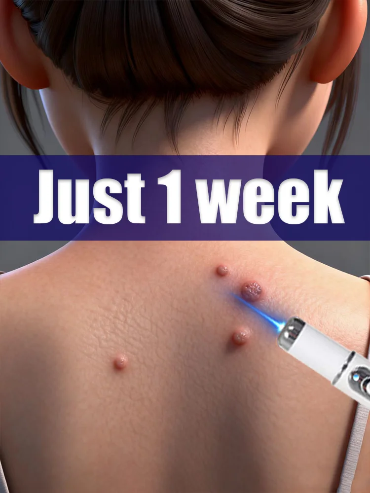 最新の疣贅除去ツールは様々な凸凹を滑らかにします。