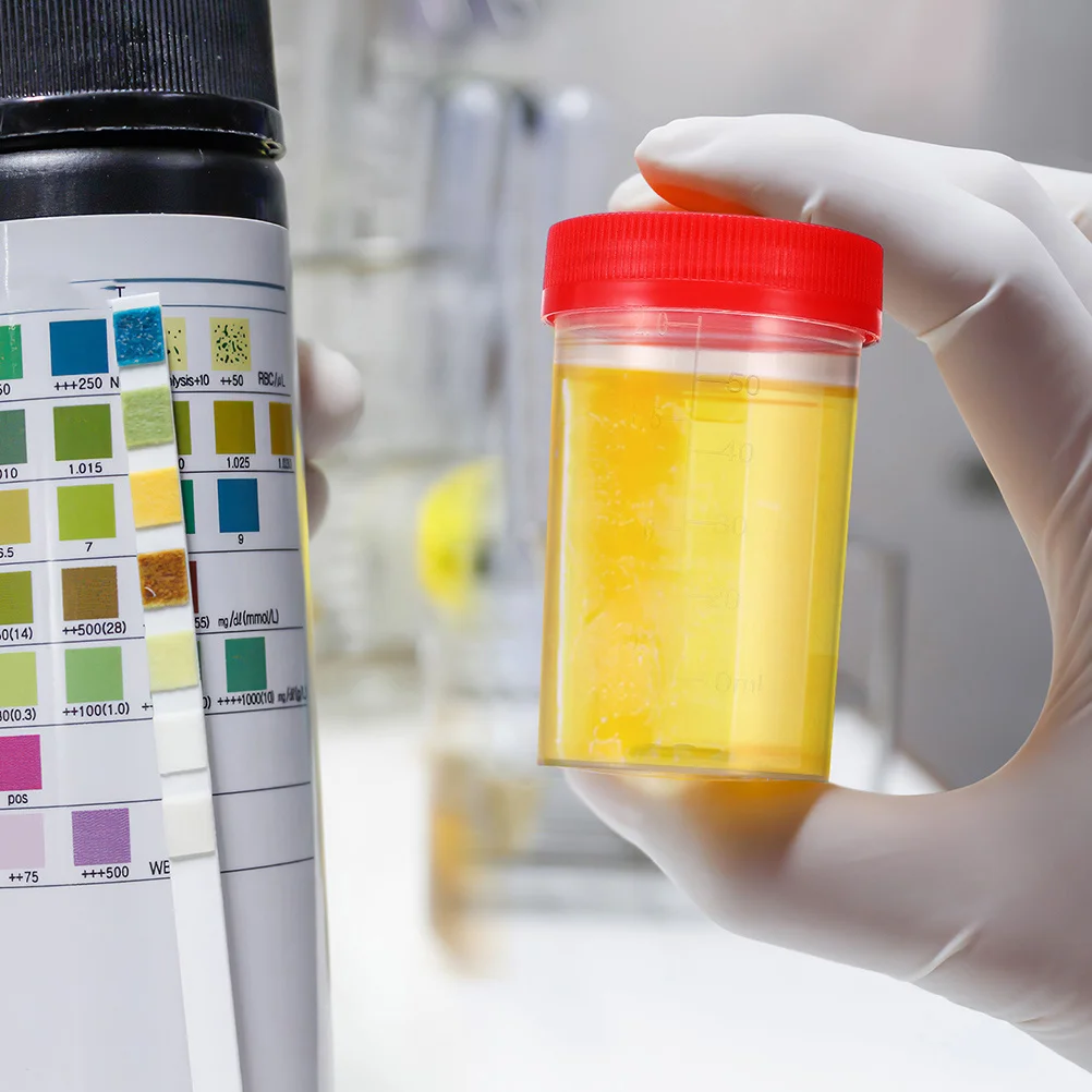 

100Pcs Specimen Cup Urine Collection Containers Plastic Screw Lid Secure Sample Bottles Urine Sample Bottle Specimen Bottle