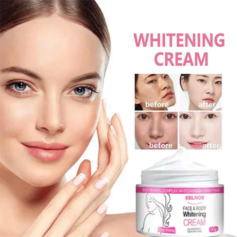 

Effective Improve Body Whitening Cream Armpit Legs Knee Elbow Bleaching Cream Dull Remove Dark Spots Melanin Brighten Skin Care