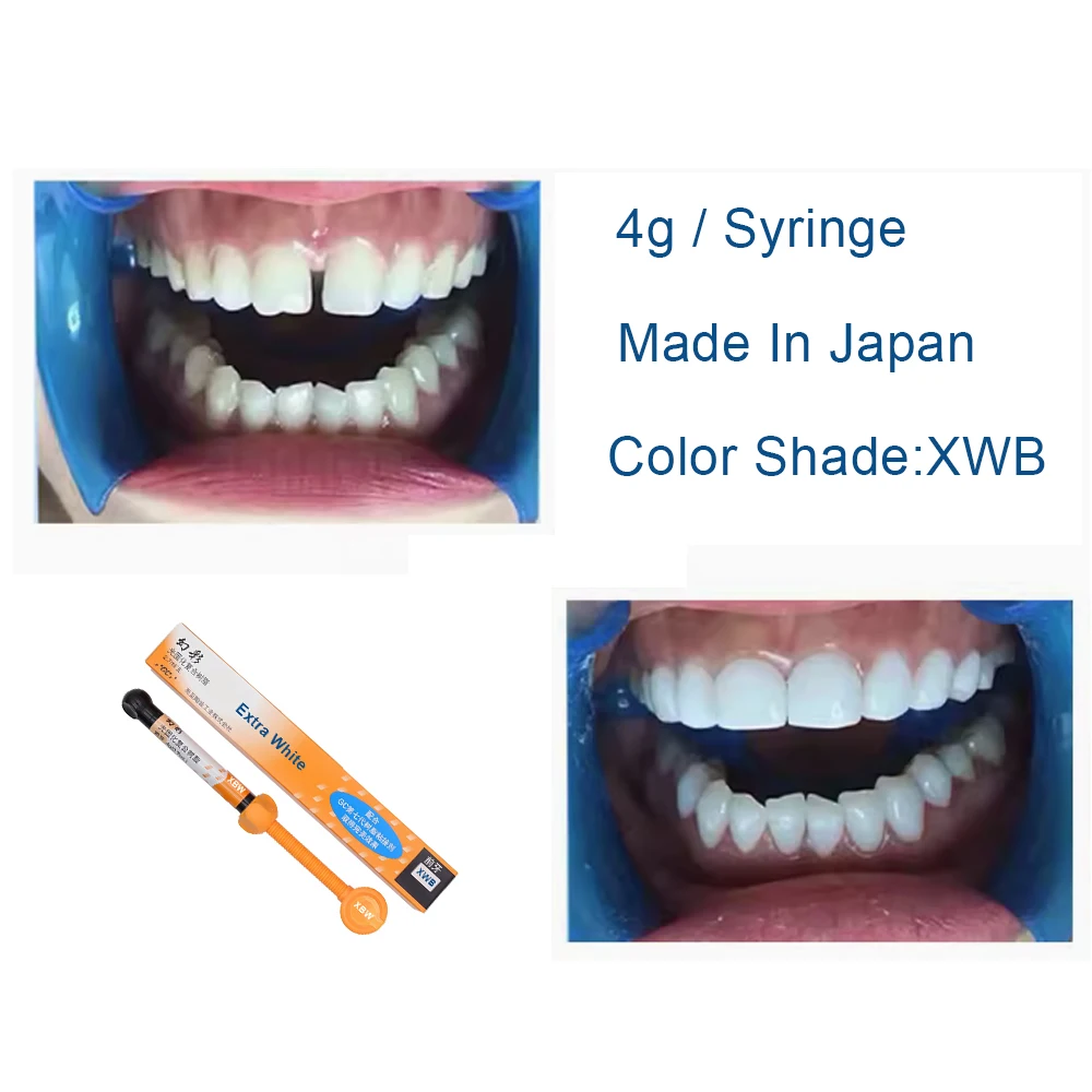 Dental Composite Resin Extra White XBW BW Beauty Bleach White Teeth Veneer Resin Light Cure Opaque Professional Dentistry Materi