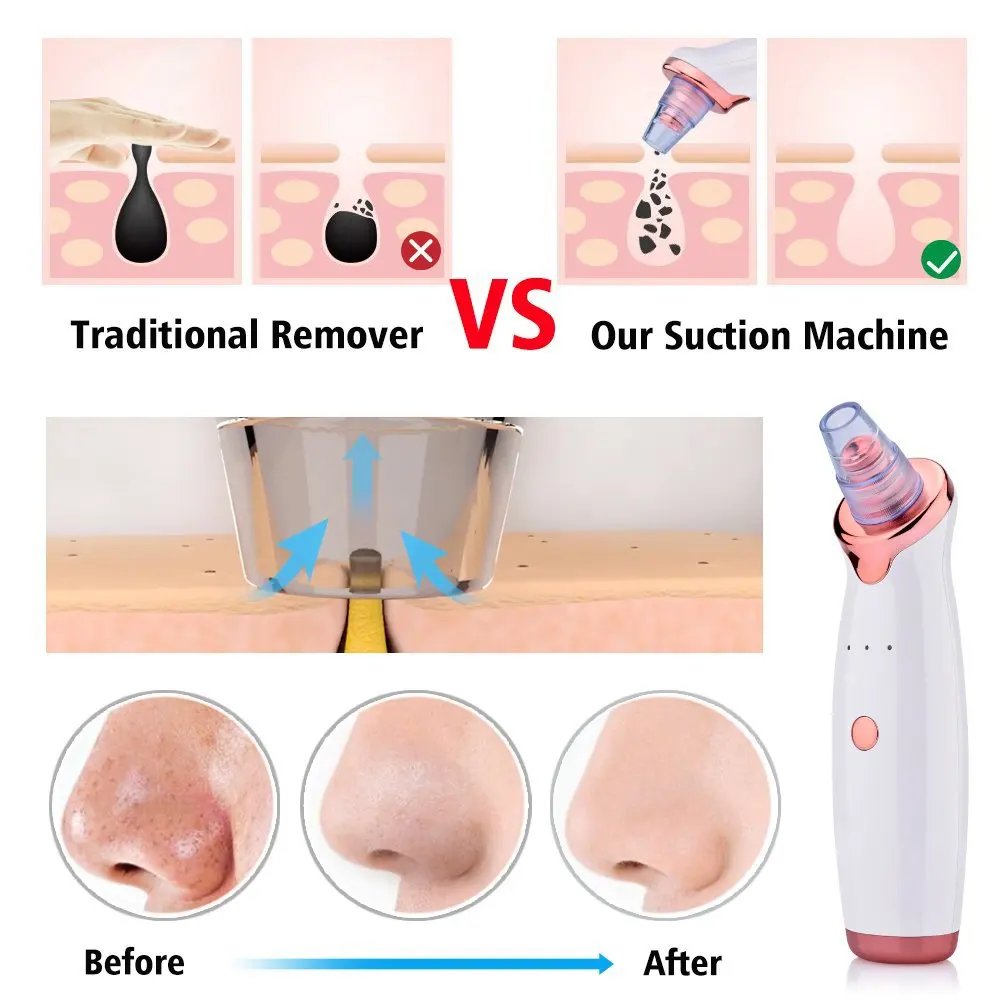 USB Recarregável Blackhead removedor, sucção a vácuo, Pore Cleaner, Extrator, Acne, Comedone, Whitehead, Remoção de espinha, Spot Cleaner