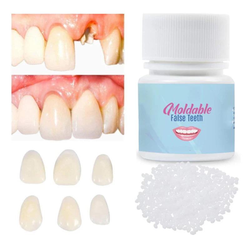 ResinTemporary Tooth Repair Kit Teeth And Gaps FalseTeeth Solid Glue Denture Adhesive Teeth Whitening Tooth Beauty 5g/20g