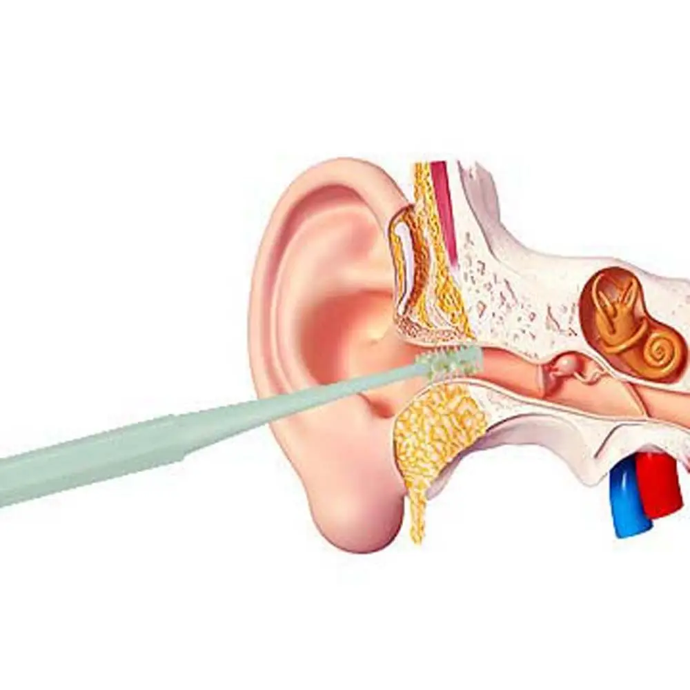 Cureta portátil para oídos, limpiador de cera de doble cabeza, cuchara de silicona, recogedor de cera