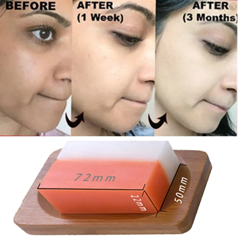 Kojic Acid Glutathion Skin Whitening Soap Dark Black Skin Lightening Soap Kojic Acid Glycerin Brighten Face Body Skin Bleaching