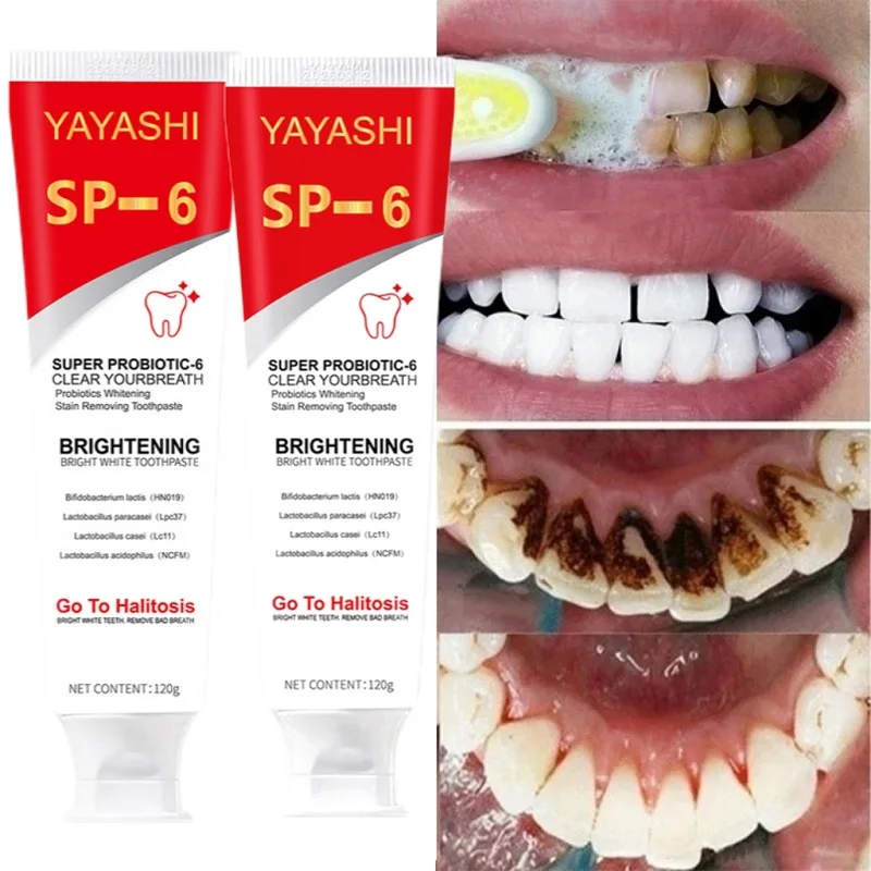 Pasta de dientes probiótica SP-6, blanqueador dental, elimina manchas de placa, higiene bucal, aliento fresco, 120g, nuevo