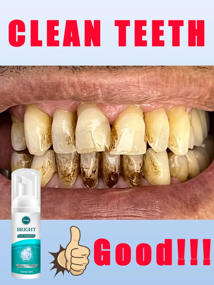 

Teeth cleaning care tools,oral foam,hot sale,Free shipping,beauty