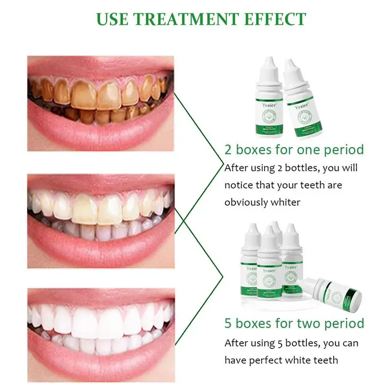 Esencia limpiadora de dientes rápida y efectiva, blanqueamiento bucal para dientes sensibles, tratamientos de lavado bucal