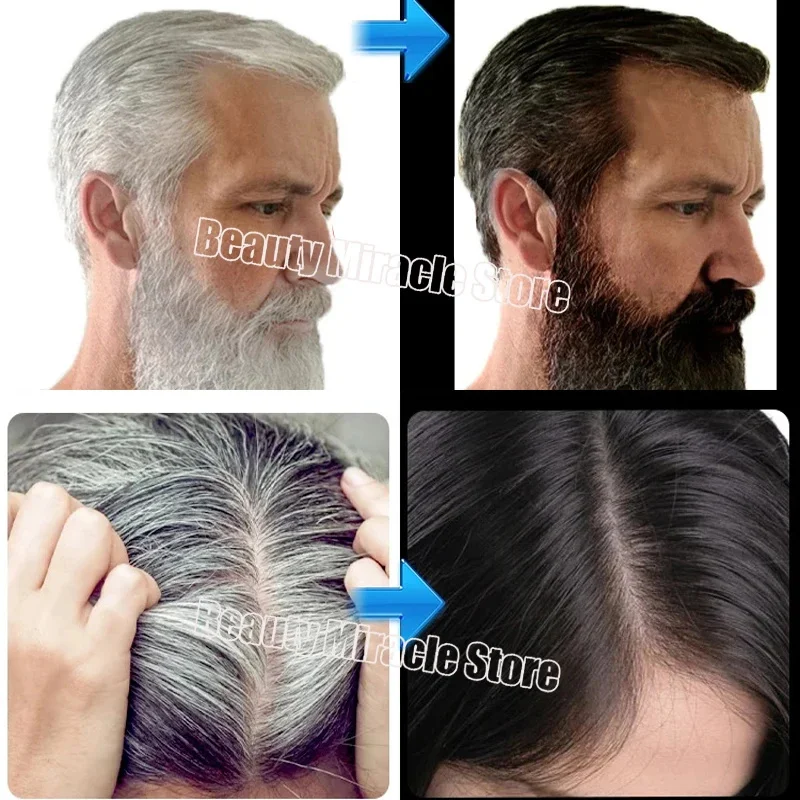 Gray White Hair Treatment Serum Soap Fast White To Black Repair Nourish Beard Hair Roots Shampoo Men Women Beauty Health Care