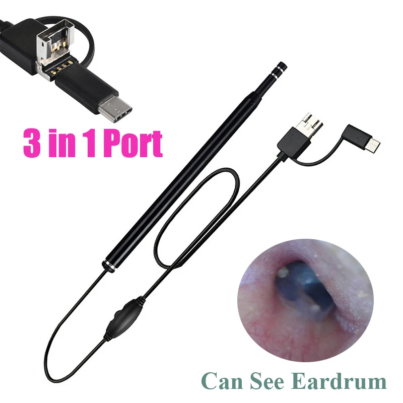 

Medical USB Ear Cleaning Tool HD Visual Earwax Spoon Earpick Otoscope with Mini Camera Pen Ear Care In-ear Cleaning Endoscope