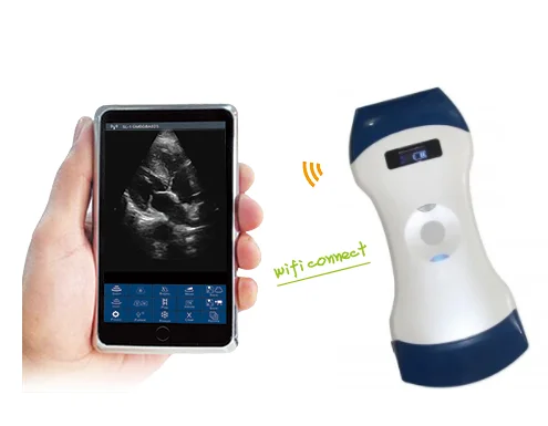 Newest Mini Wifi 128 Elements 3 In 1 Color Doppler Portable Wireless Ultrasound Probe Scanner