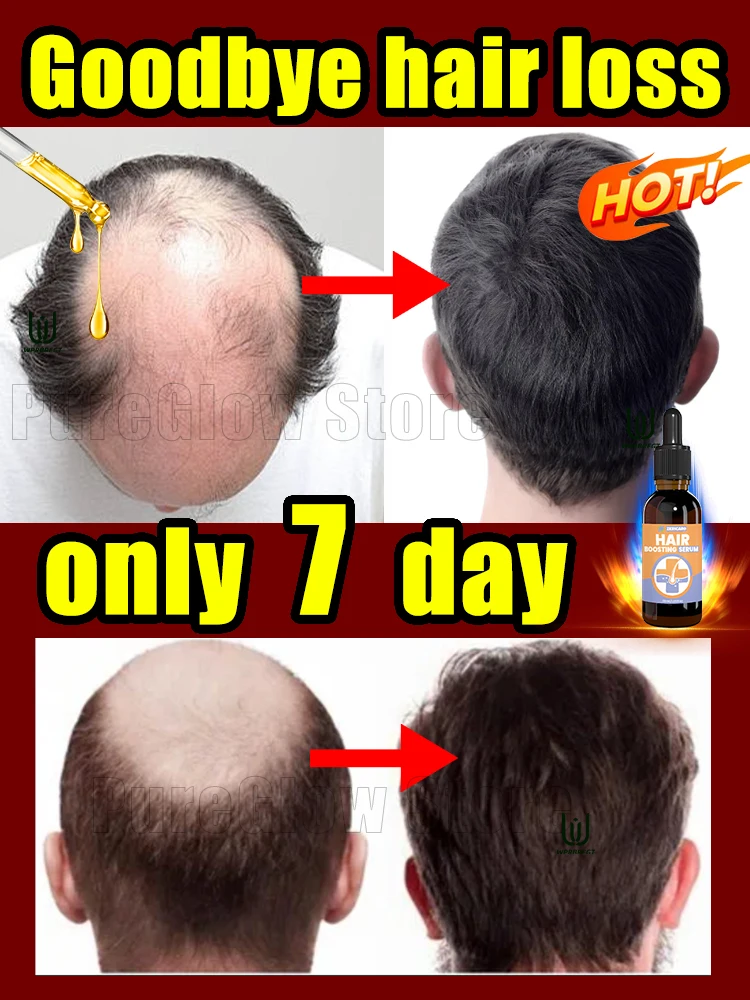 98% of buyers buy again, have more and more hair, say goodbye to baldness, thick hair,Hot selling product.