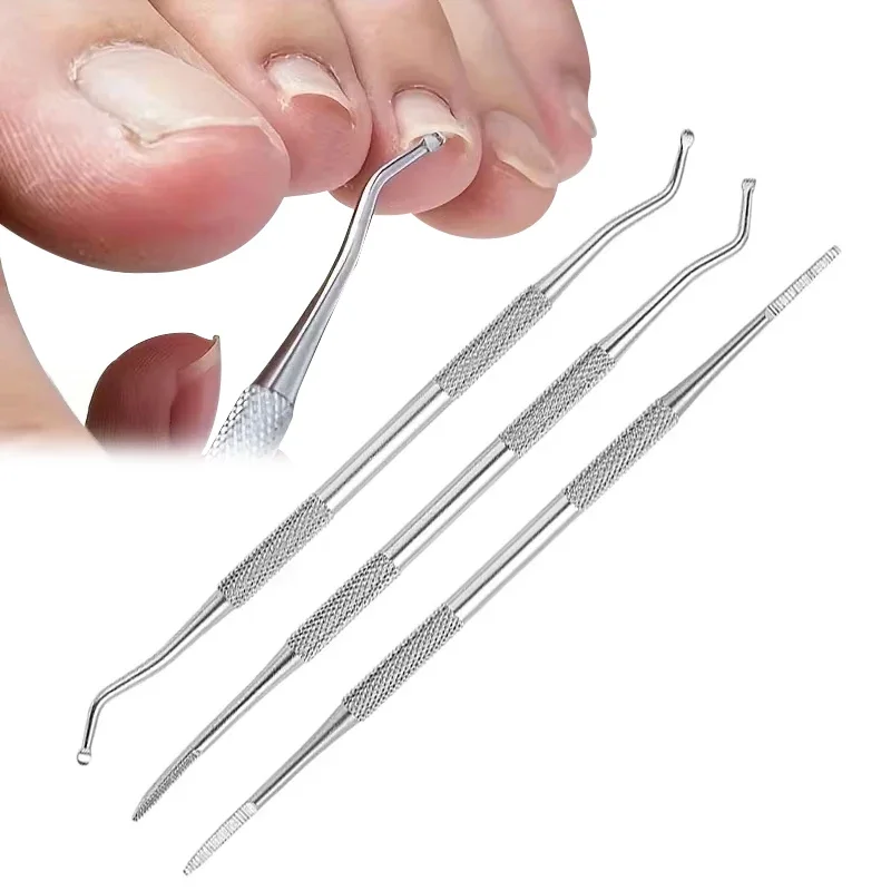 

2/3Pcs Toenail Clipper Ingrown Manicure Fixer Recover Toe Care Tool Nail Tool Correction Nail Files Pedicure Manicure Tool