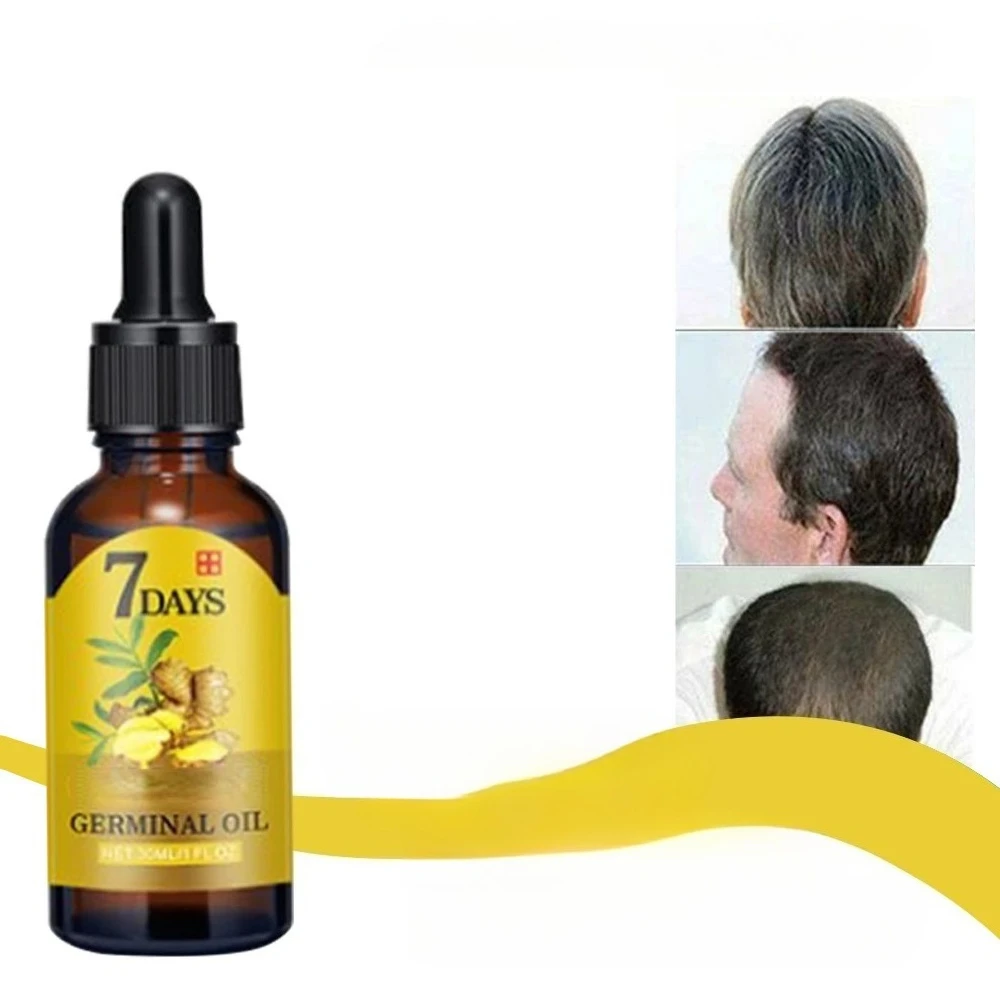 Fast Hair Growth Men Women Ginger Growth Hair Oil Treatment Anti Hair Loss Scalp Treatment Serum Products Beauty Healthwholesale - view 5