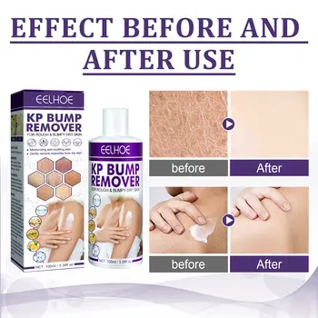 8 best sales جلد الدجاج - №4