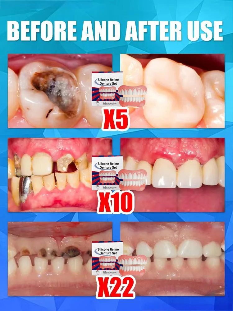 Thumbnail 2 - #68 Compare Dentures Before You Buy