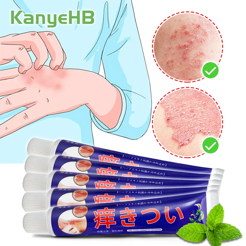 

1-3-5pcs Skin Disease Treatment Ointment Cooling Anti-itch Antifungal Cream Pityriasis Psoriasis Cream Mint Cooling Eczema Cream