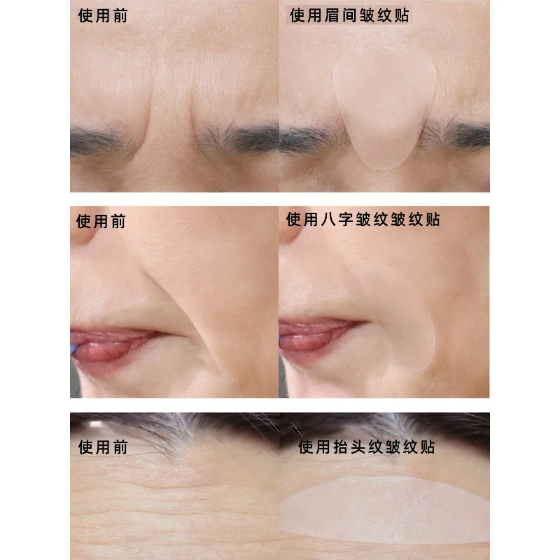 Korean Oliveyoung Marshique Wrinkle Repair Patch Anti Wrinkle Patches for Face Neck Forehead Eye Cheek Chest Pads Beauty Tools