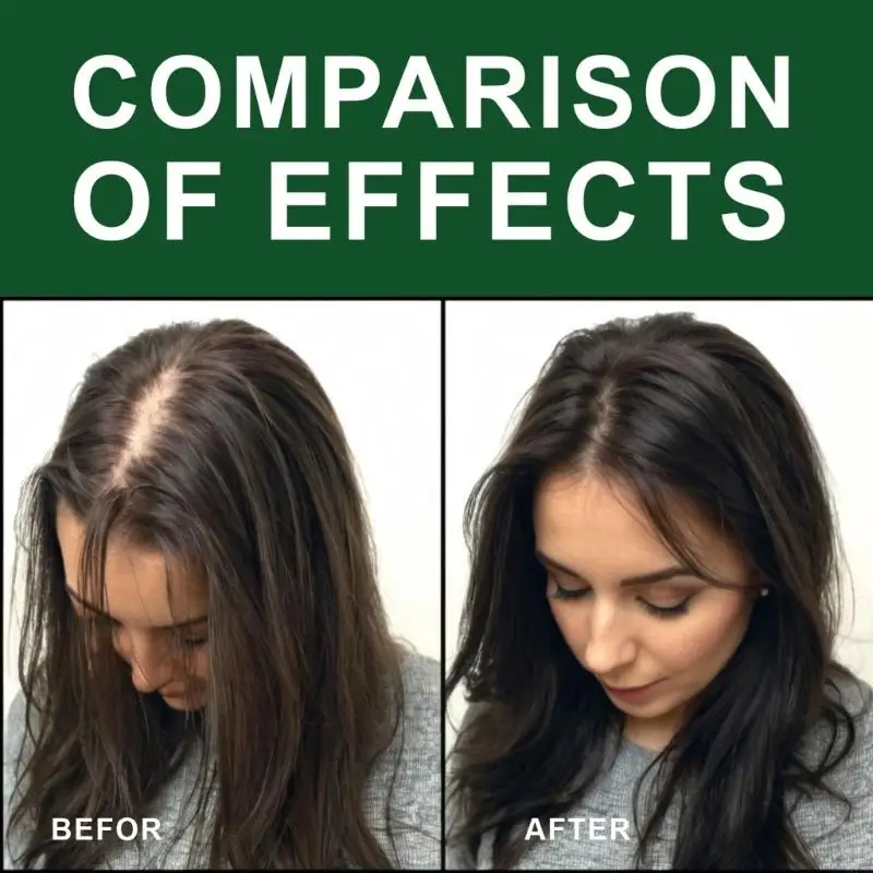 918d Tóc tăng trưởng kích thích Tóc dầu gội đầu kiểm soát dầu chăm sóc tóc