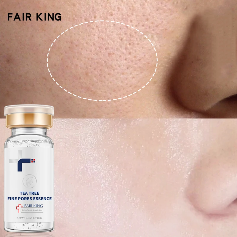 Chá árvore poro encolhimento ácido hialurónico hidratante soro facial melhorar os poros ampliados pele seca suave pele firme cuidados faciais