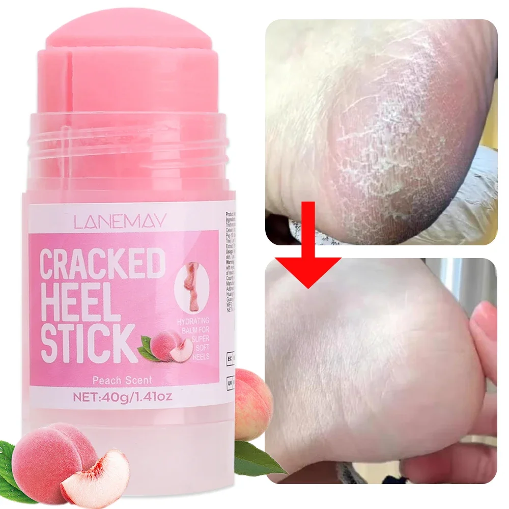 Ultra-Hydrating Foot Care ครีม Anti-Drying Crack Removal Dead Moisturizing Skin Hand Feet Care Softening Calluses Cracked ครีม