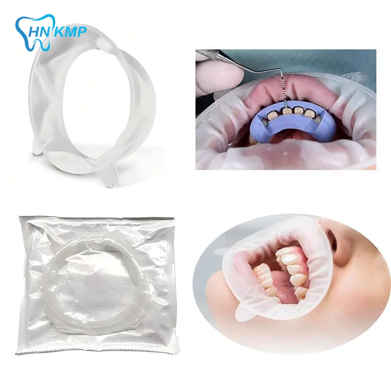 3D Soft Dental Mouth Opener O Shape Lip Cheek Retractor Food Safe Rubber Oral Expander for Dentist Office Home Oral Care Use