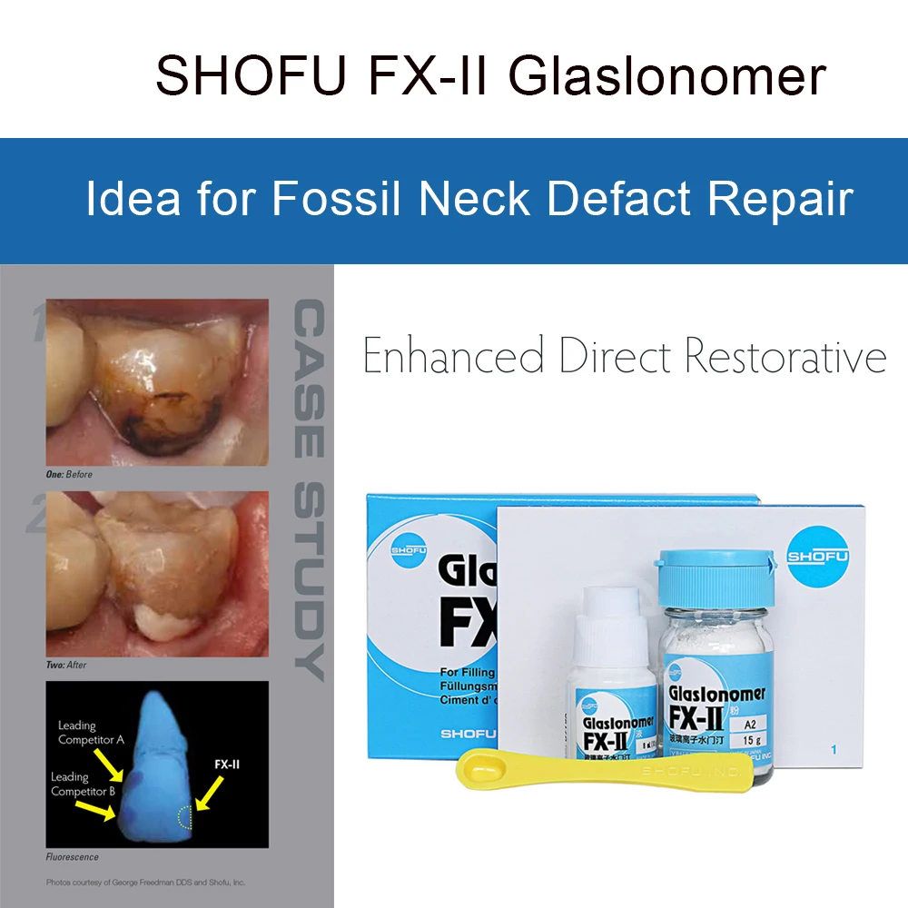 

Dental Supplies ShoFu FX-II Glaslonomer Cement Gic Filling Material Enhanced FX II Fossil Neck Defect Repair Dentistry Products