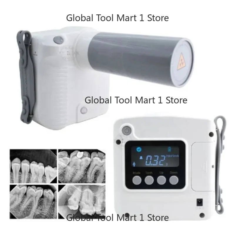 Intraoral Digital X…