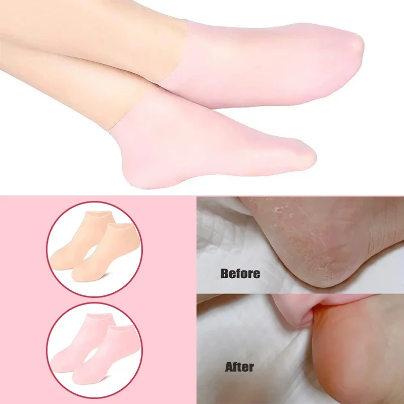 Fuß-und Handpflege socken Handschuhe Anti-Trocken-Cracking Dead Skin Removal Protector Schmerz linderung feuchtigkeit spendende Füße Silikon gel