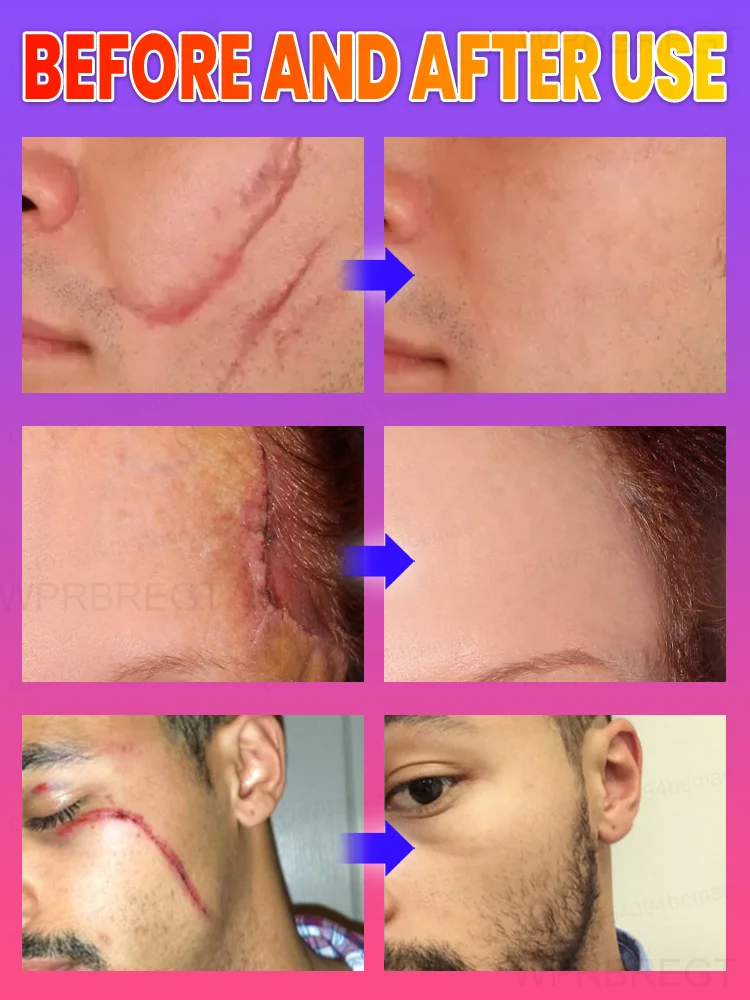 Do you want to have perfect skin?