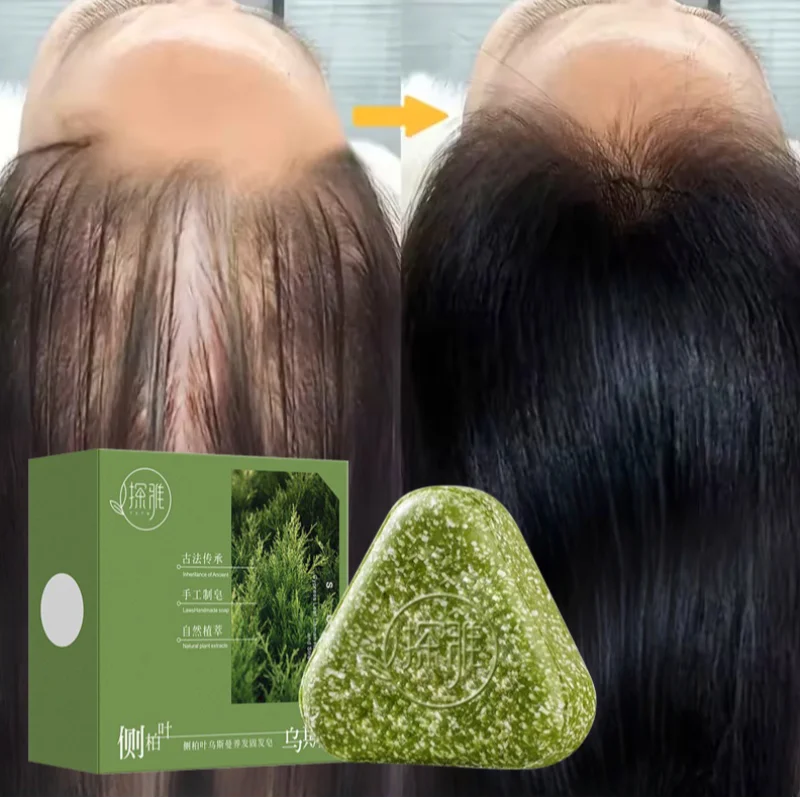 صابون شامبو عشبي طبيعي صابون عوسمان جراس مصنوع يدويًا مغذي للشعر، تحكم في الزيت، منعش، رقيق ومهدئ للعناية بالشعر