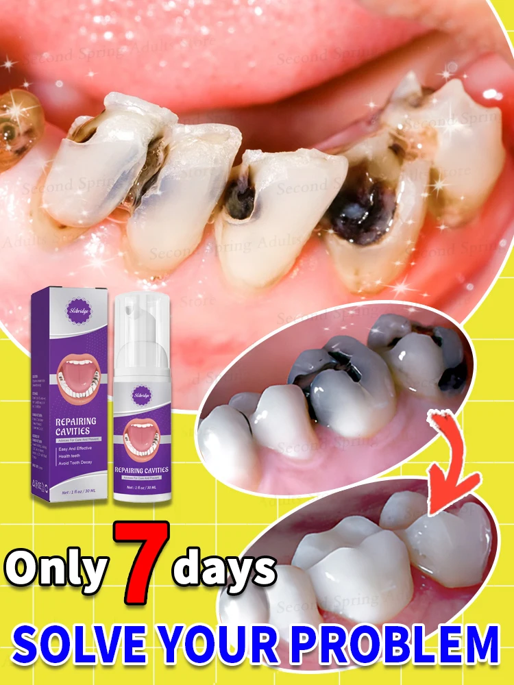 

99% of people will repurchase this Hot selling cavity repair mousse decay for removal