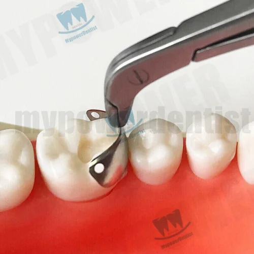 Imagen 2 del producto Anillo de bandas de matriz Dental, abrazadera de aleación de titanio de matriz seccional compatible con sistema V3